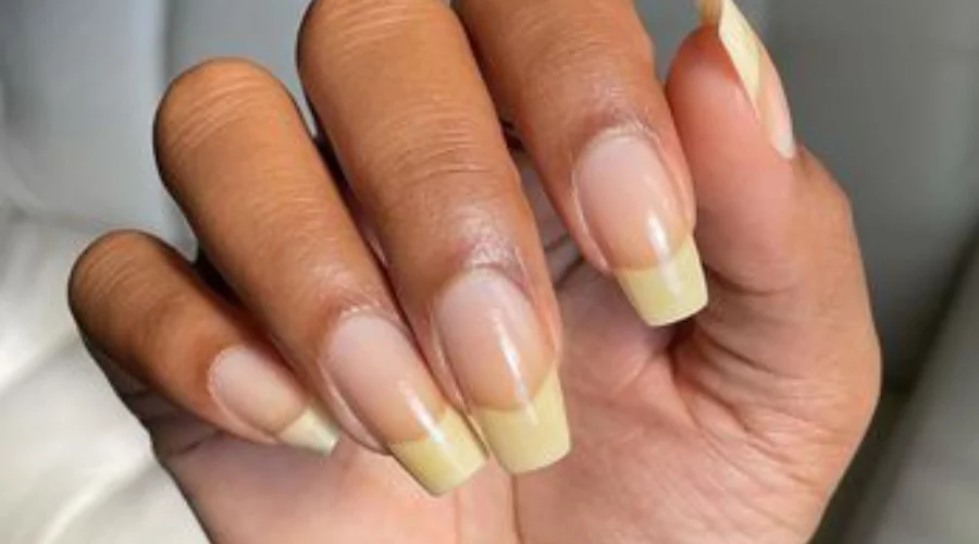 Banishing Yellow Nails Causes Remedies and Prevention